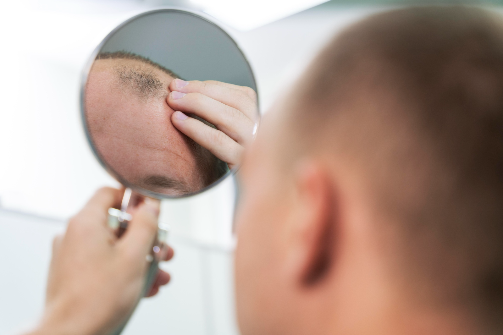 How Strip Hair Transplants Work to Restore Thicker Hair